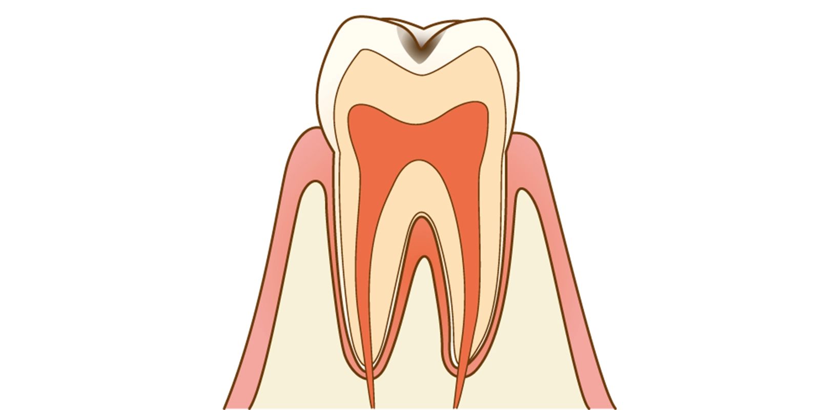 C1